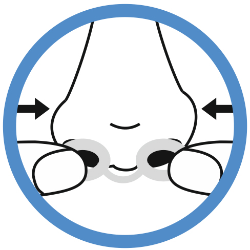 pasul-3-Dilatator-Nazal-BetterSleep